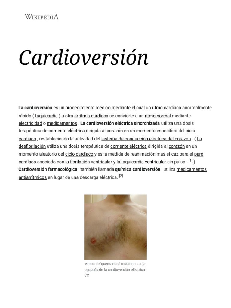 Cardioversión - Wikipedia | PDF | Cardiología | Corazón