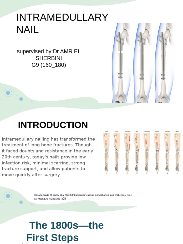 Intramedullary Naill | PDF | Titanium | Clinical Medicine