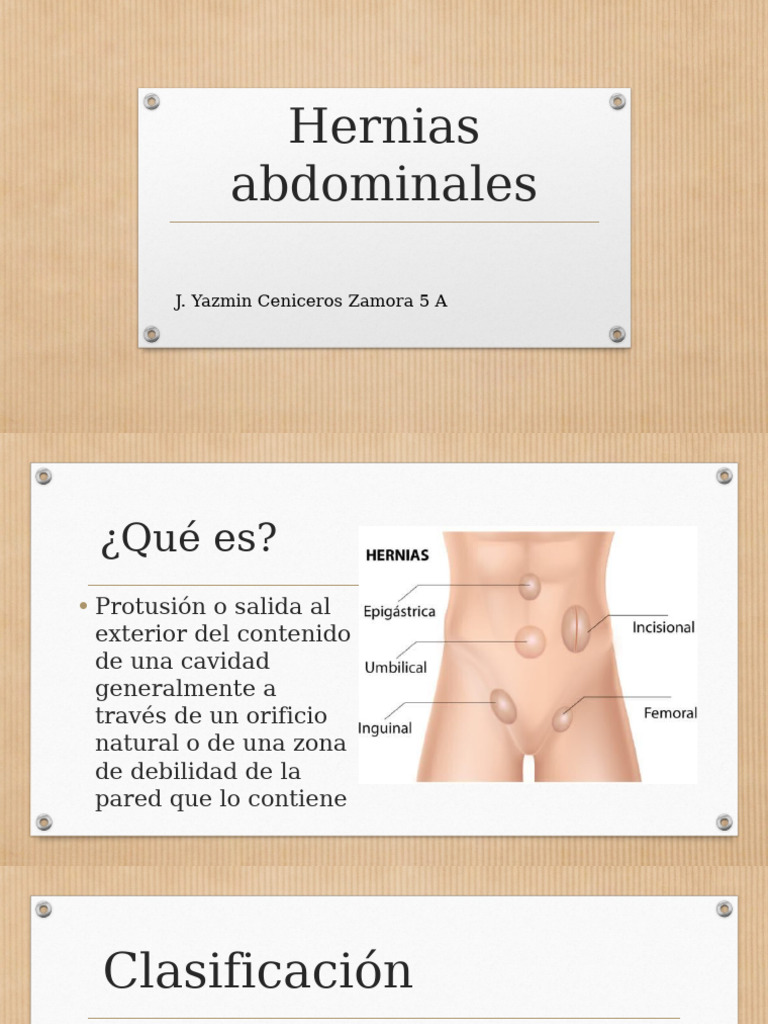 Tipos y Tratamientos de Hernias Abdominales | PDF