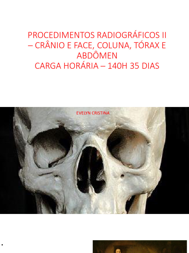 Anatomia Radiológica do Crânio e Face | PDF | Crânio | Cabeça e pescoço ...