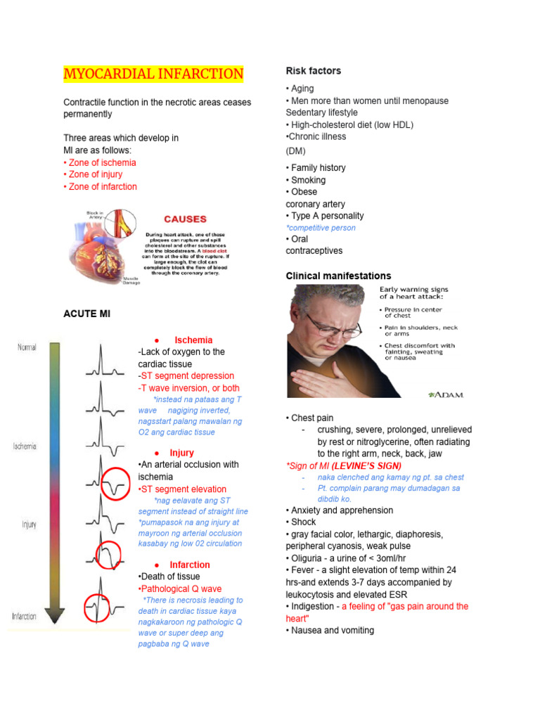 Understanding Myocardial Infarction | PDF | Myocardial Infarction ...