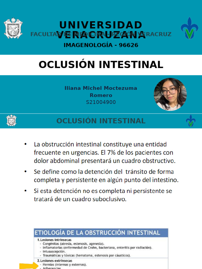 Oclusión Intestinal: Diagnóstico y Hallazgos | PDF