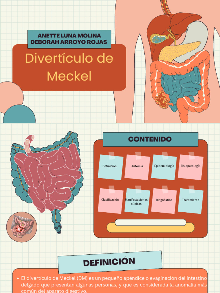 Divertículo de Meckel | PDF | Tracto gastrointestinal | Especialidades ...