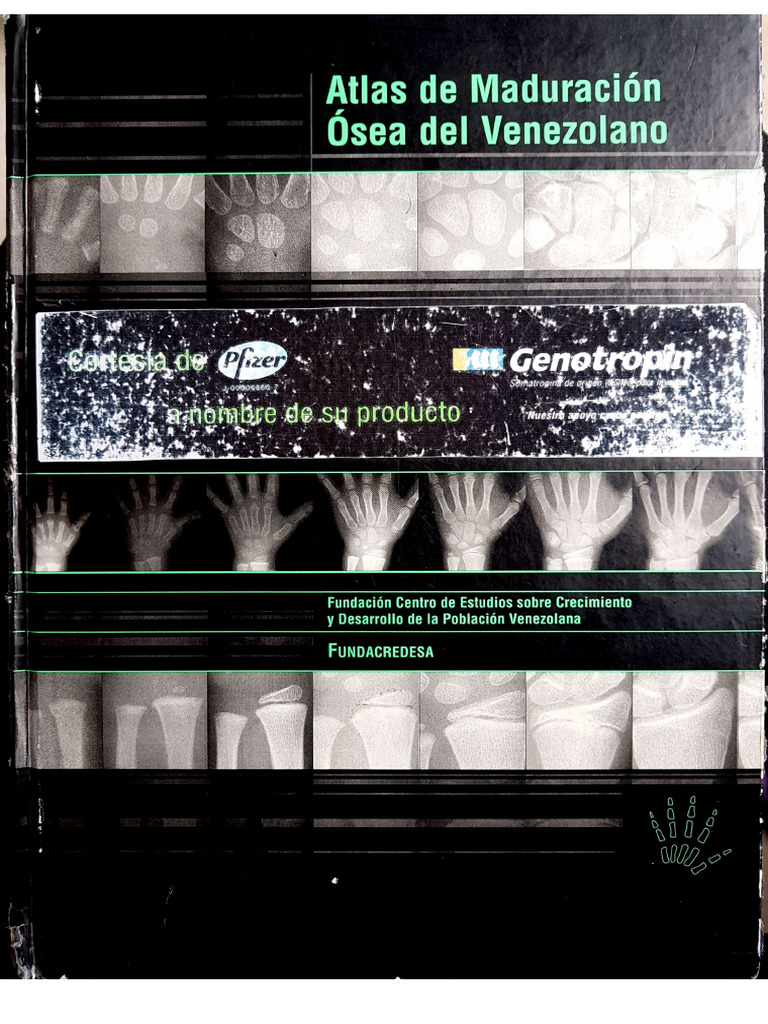 Atlas de Maduracion Osea Del Venezolano. Fundacredesa 2003 1era Edic | PDF