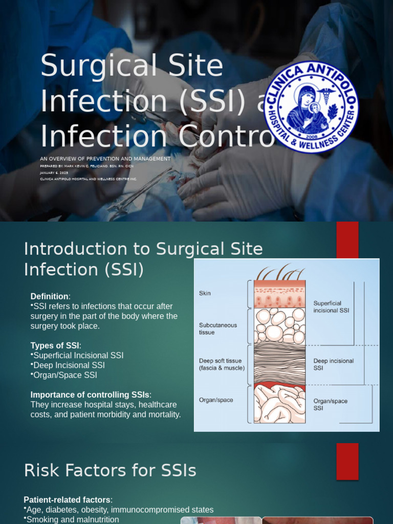 Overview of Surgical Site Infections | PDF | Surgery | Infection