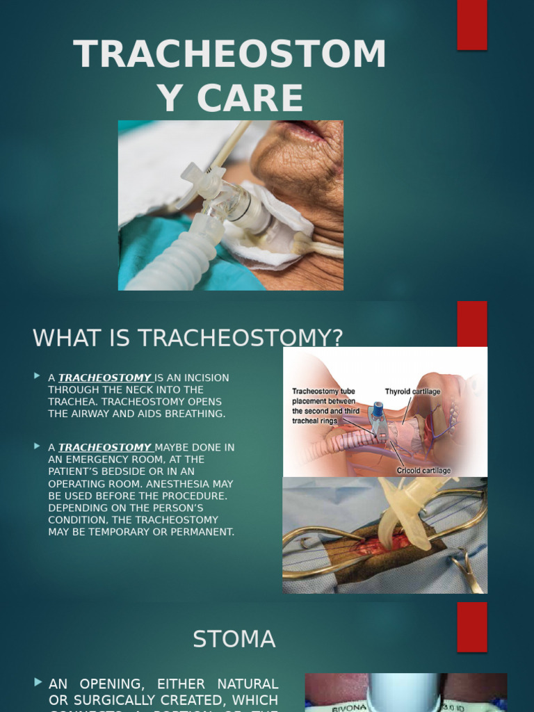 19tracheostomy Care | PDF | Respiratory Tract | Medical Specialties