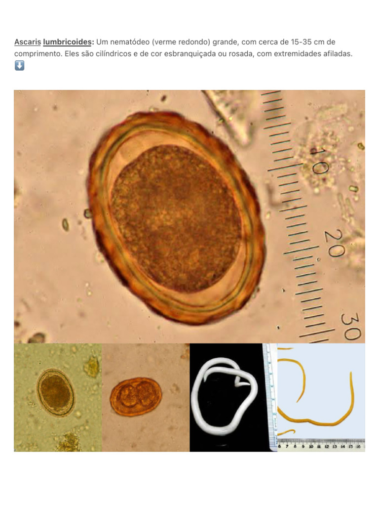 Ascaris Lumbricoides Um Nematódeo (Verme Redondo) Grande, Com Cerca | PDF