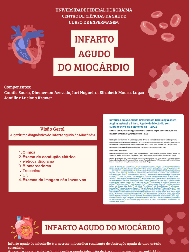Diagnóstico e Tratamento do Infarto | PDF | Infarto do Miocárdio | Coração
