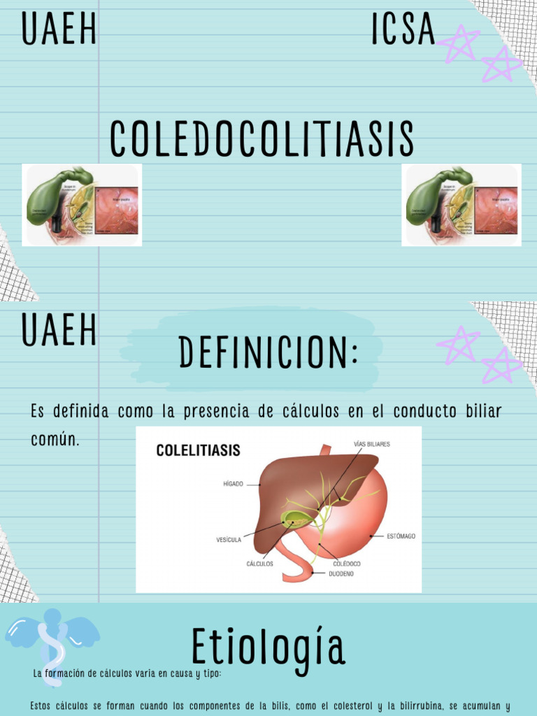 Coledocolitiasis: Causas, Síntomas y Tratamiento | PDF | Bilis ...