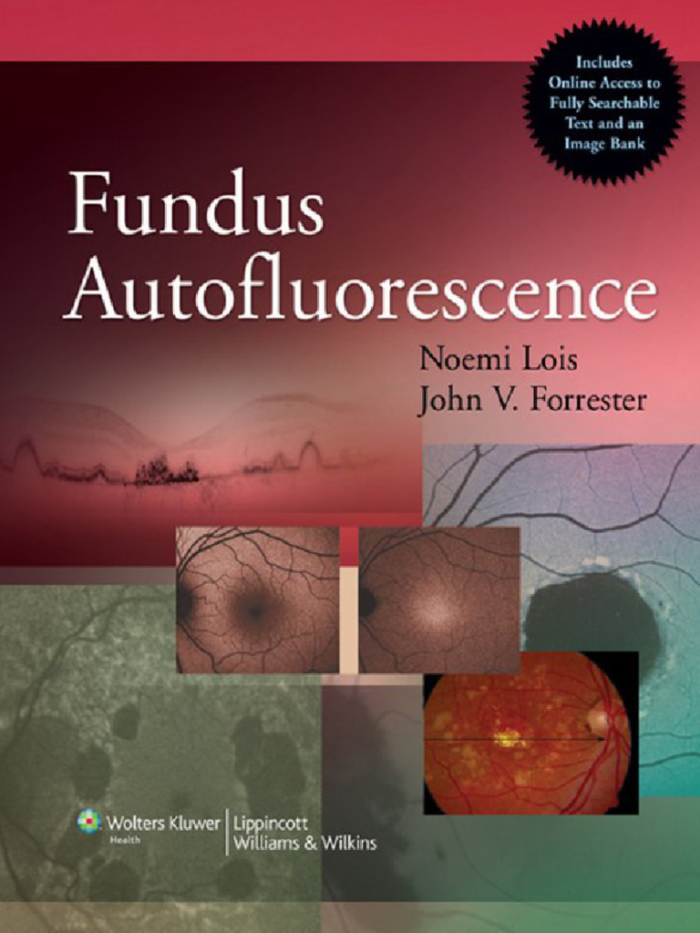 Fundus Autofluorescence | PDF | Autophagy | Reactive Oxygen Species
