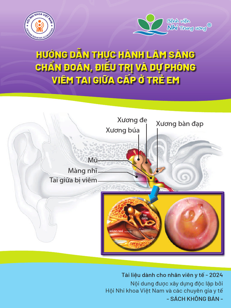 VIÊM TAI GIỮA CẤP-HỘI NHI KHOA VIỆT NAM | PDF