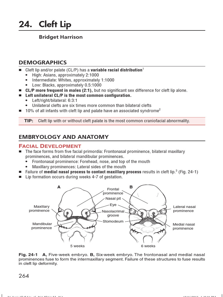 Cleft Lip Overview and Treatment Guide | PDF | Human Nose | Lip