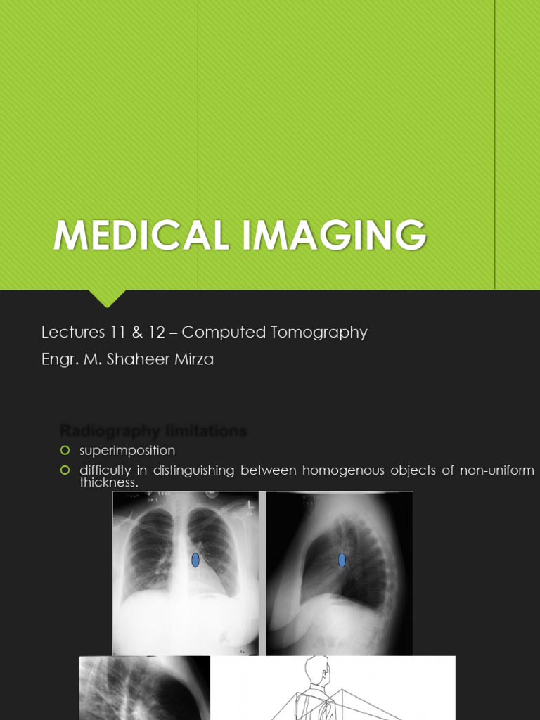 Understanding Computed Tomography Basics | PDF | Ct Scan | Tomography