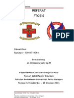 Copy of Referat Ptosis Ega Jaya - 07120060064