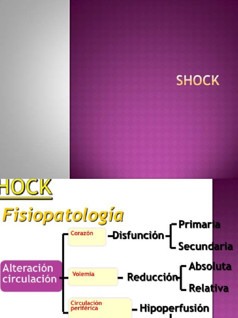 Shock | PDF