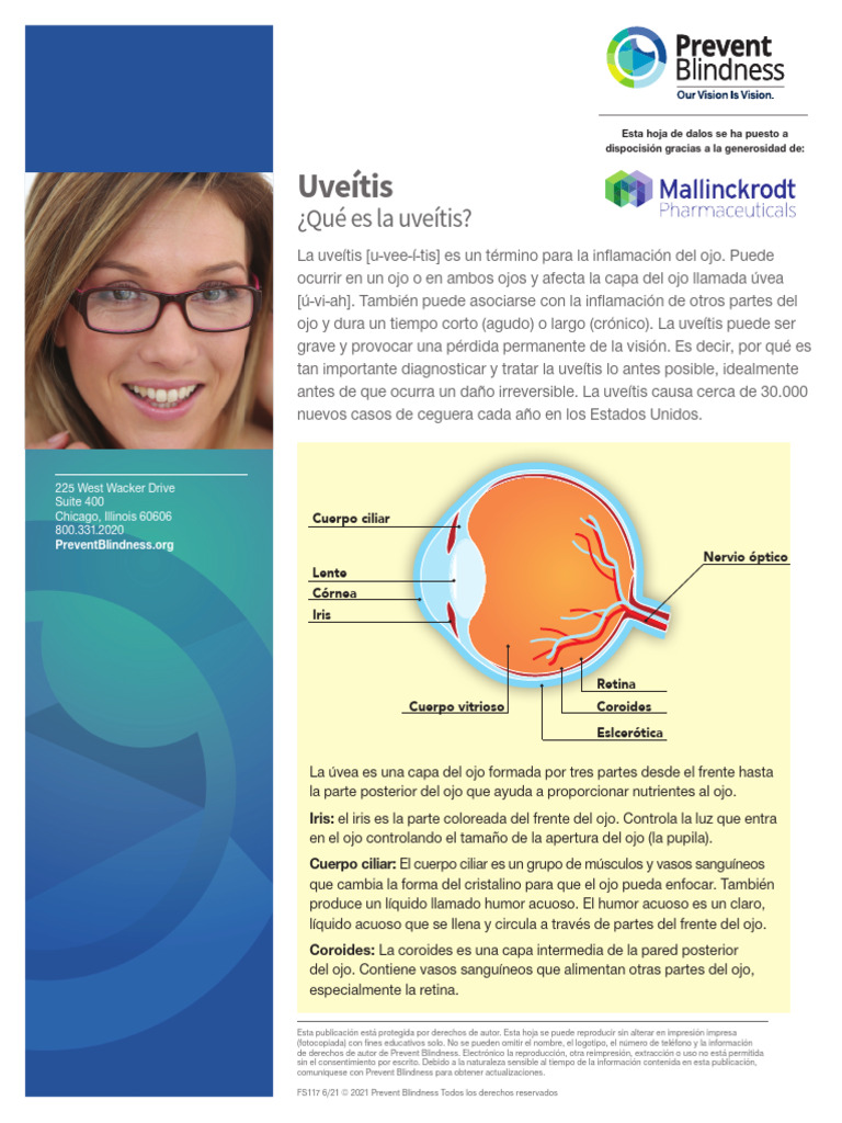 FS117 Uveitis Spanish | PDF | Ojo humano | Corticosteroides