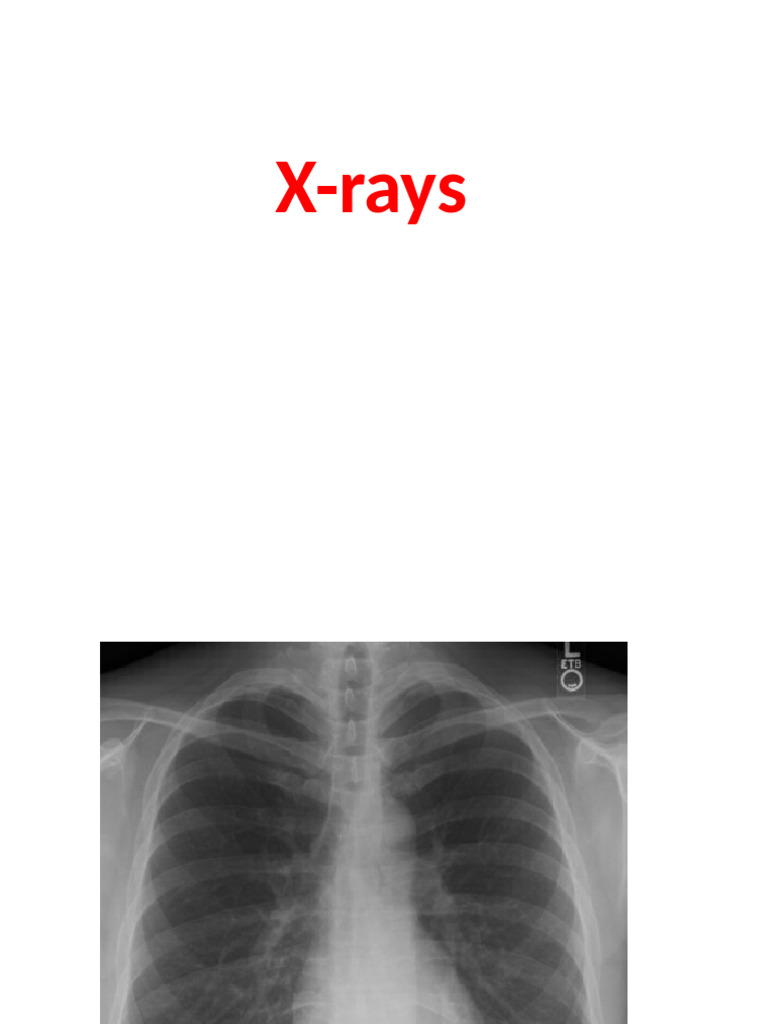 X Rays | PDF