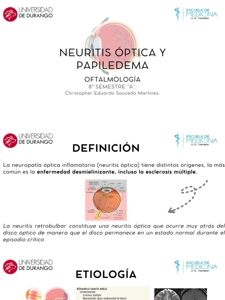 Neuritis Optica | PDF | Esclerosis múltiple | Enfermedades y trastornos
