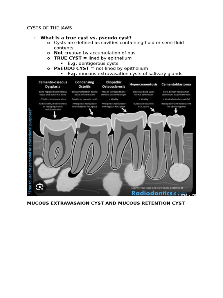 Cysts of The Jaws | PDF