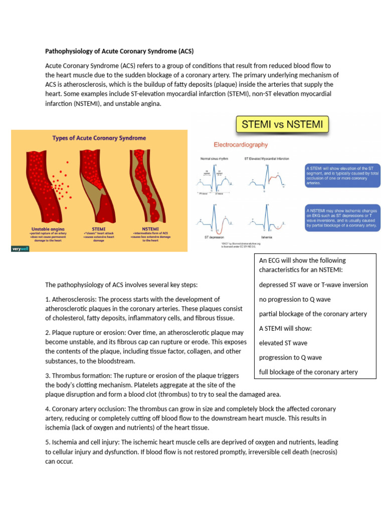 Acute Coronary Syndrome | PDF | Myocardial Infarction | Atherosclerosis