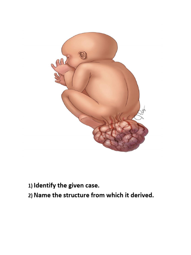 Case Analysis of Tissue Anomalies | PDF