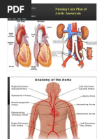Download Nursing Aneurysm by Manila Prak SN82871728 doc pdf
