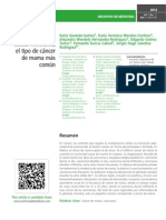 Carcinoma Ductal Infiltrante, El Tipo de Cáncer de Mama Más Común