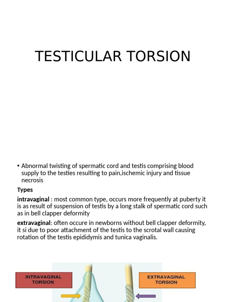 Testicular Torsion | PDF