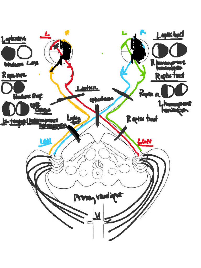 Blank Visual Pathway Diagram - 12.4 | PDF