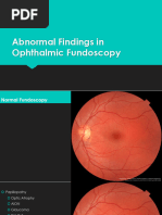 OCT Interpretation for Macula Diseases | PDF | Visual System | Diseases ...