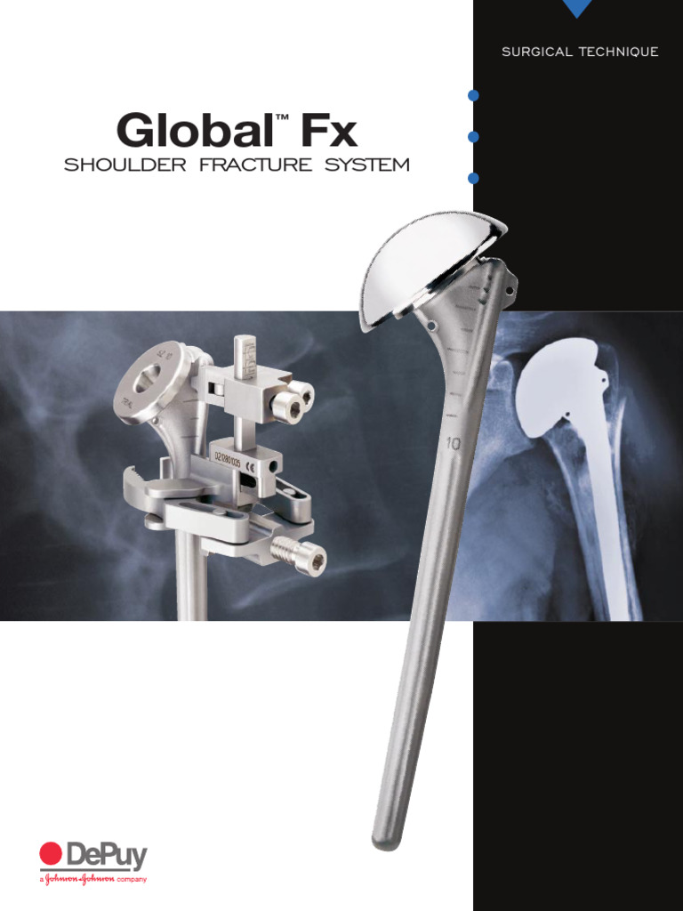 Global Fx Shoulder Fracture System Guide | PDF | Musculoskeletal System ...