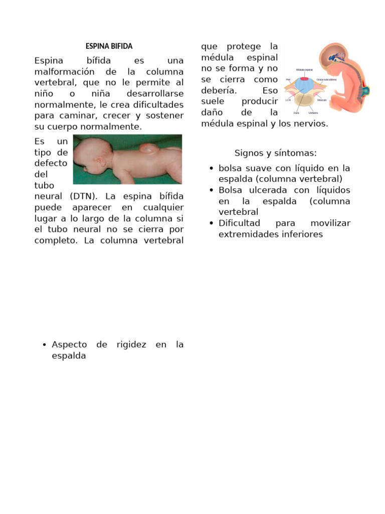 Espina Bífida: Malformación Vertebral | PDF