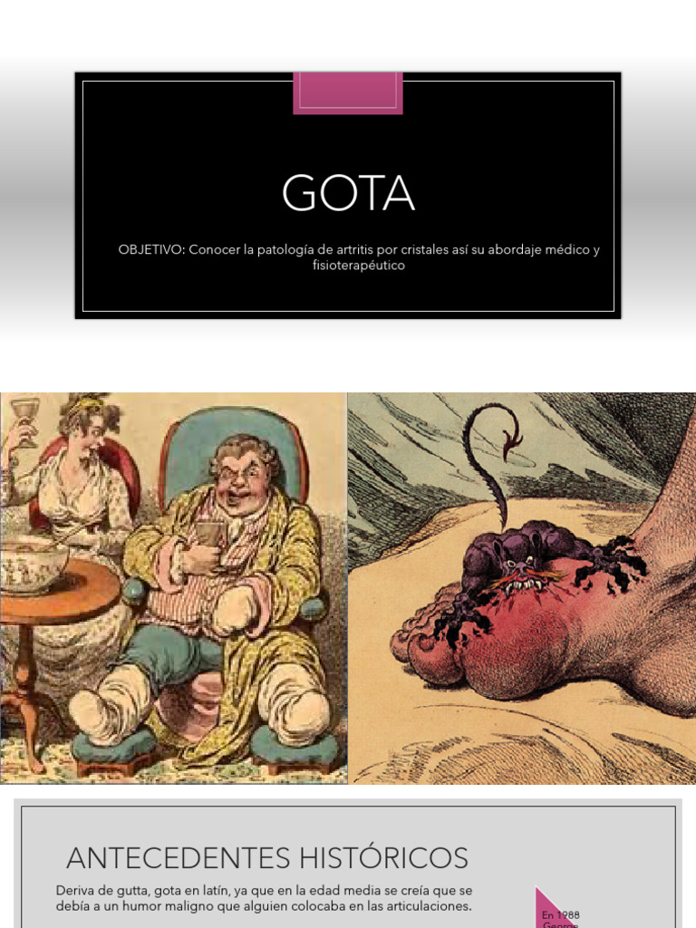 Gota: Patología y Tratamiento | PDF | Gota | Medicina CLINICA