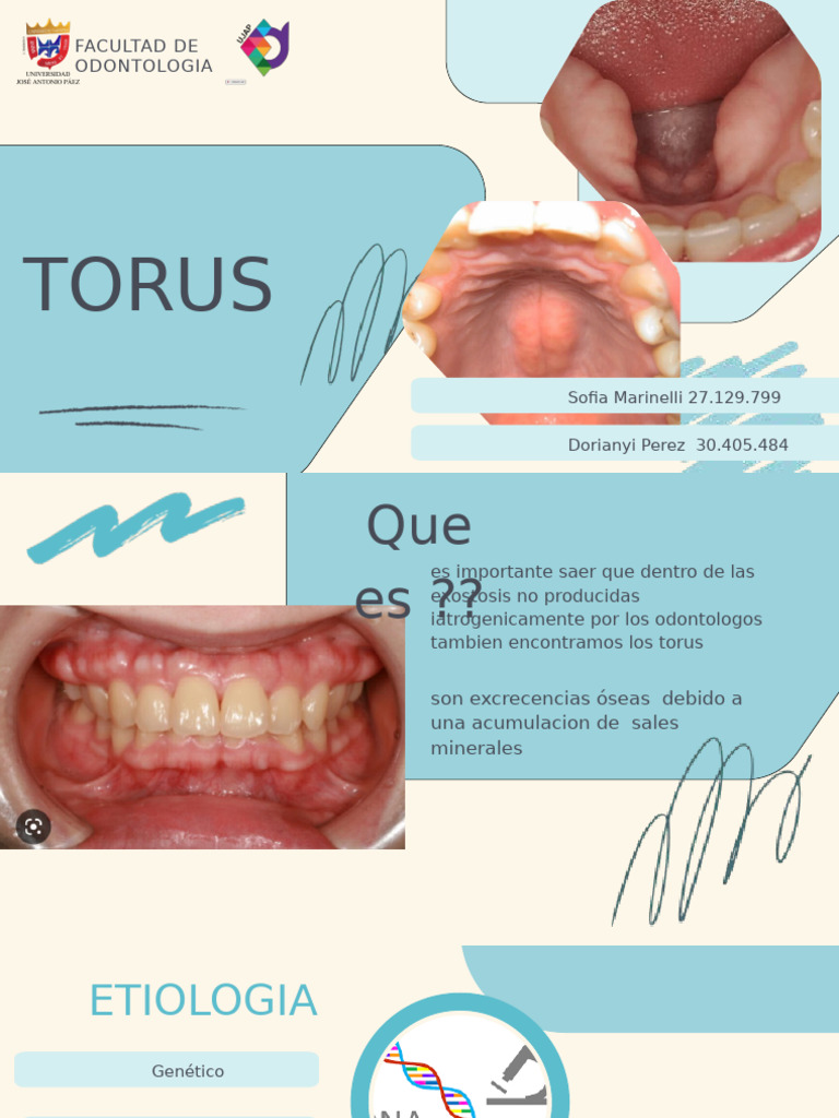Torus | PDF | Medicina CLINICA | Especialidades Medicas