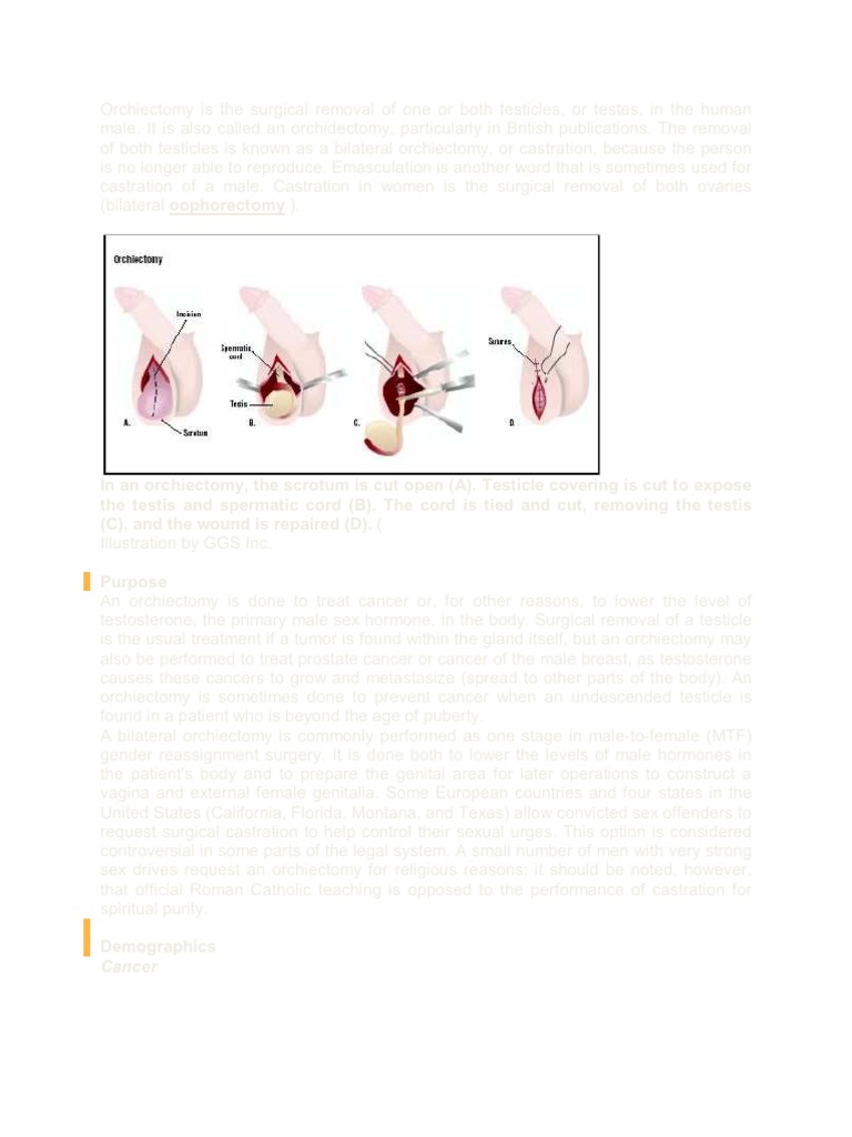 Understanding Orchiectomy Procedures | PDF | Sexual Anatomy | Cancer