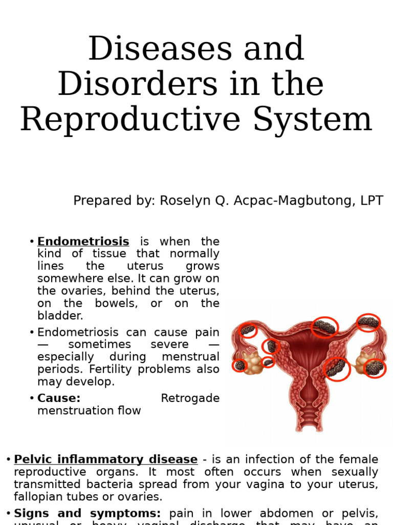 Reproductive System Diseases Overview | PDF | Vagina | Uterus