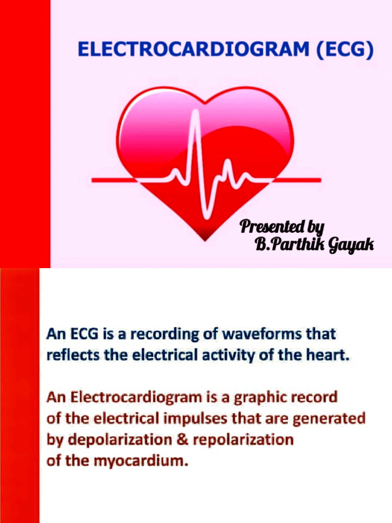 Parthik Phy ECG | PDF