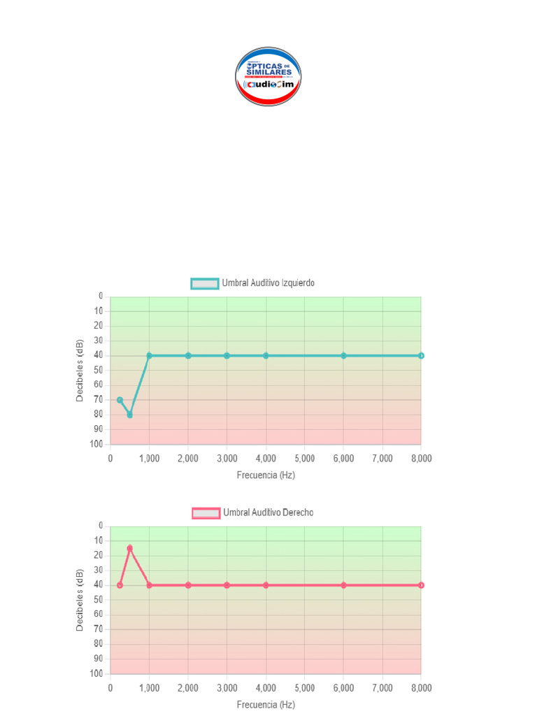 Audiometria | PDF