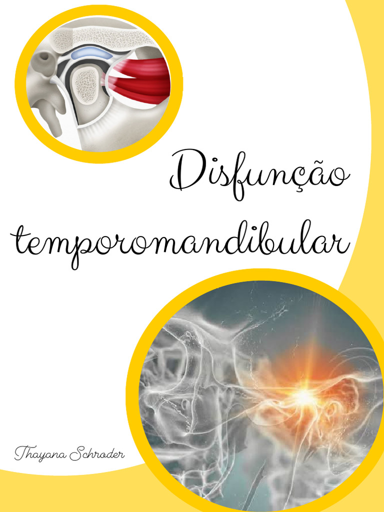 Disfunção Temporomandibular (DTM) | PDF | Dor | Sinapse