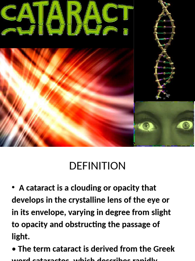 Cataract Pdf Cataract Ophthalmology
