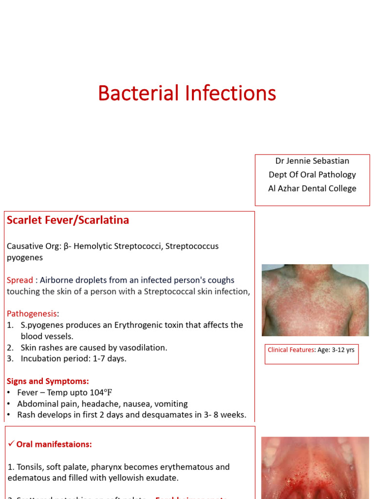 Bacterial Infections | PDF | Tuberculosis | Necrosis