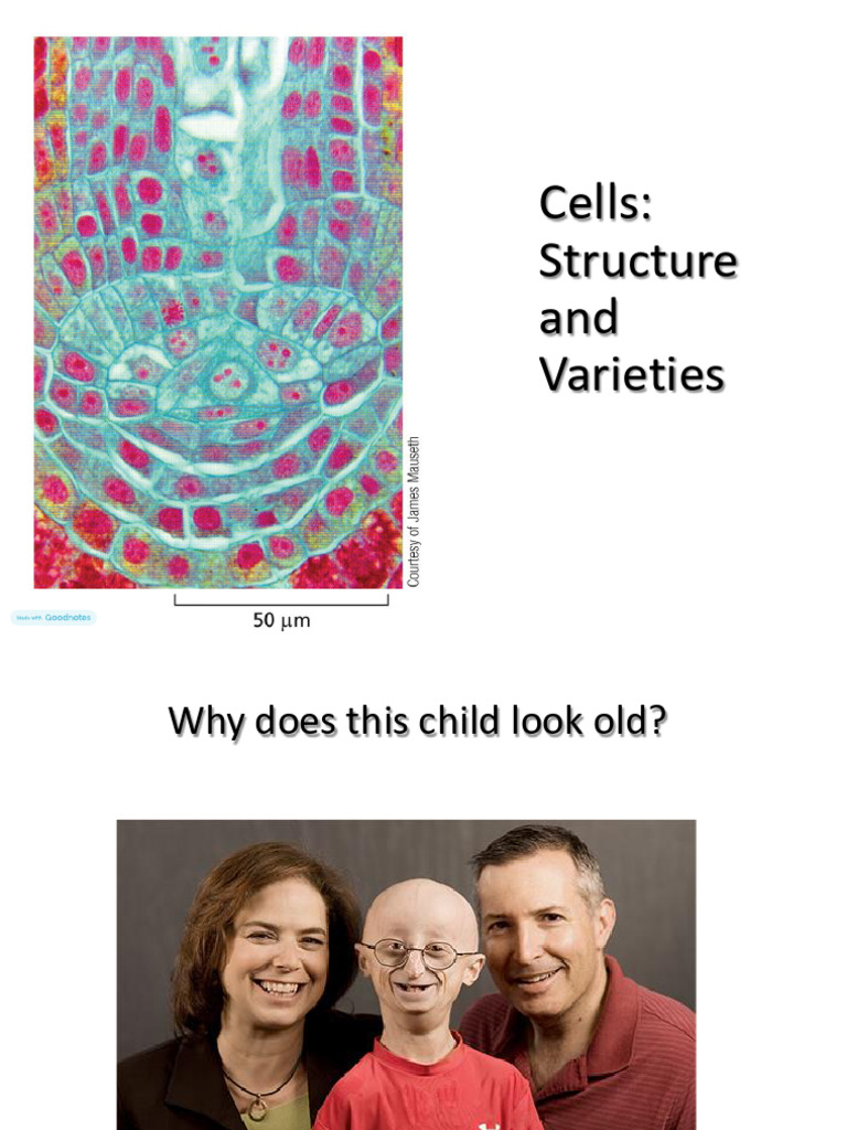 Progeria and Cell Structure Explained | PDF | Endoplasmic Reticulum ...