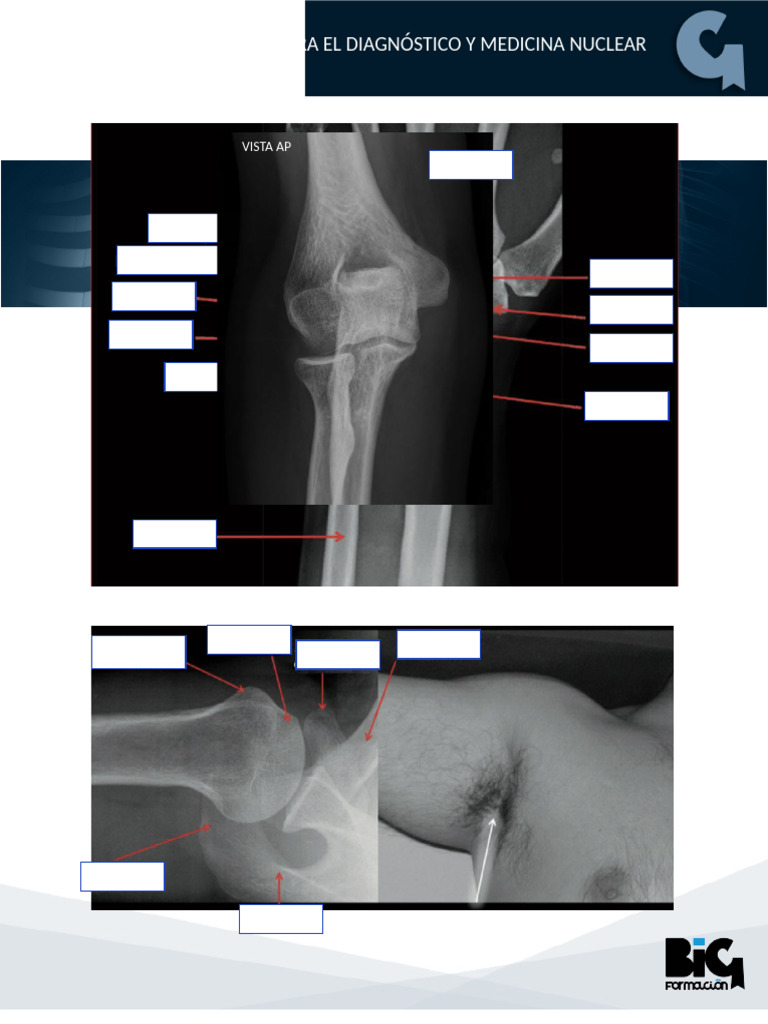 Lamina Anatomia MMSS | PDF