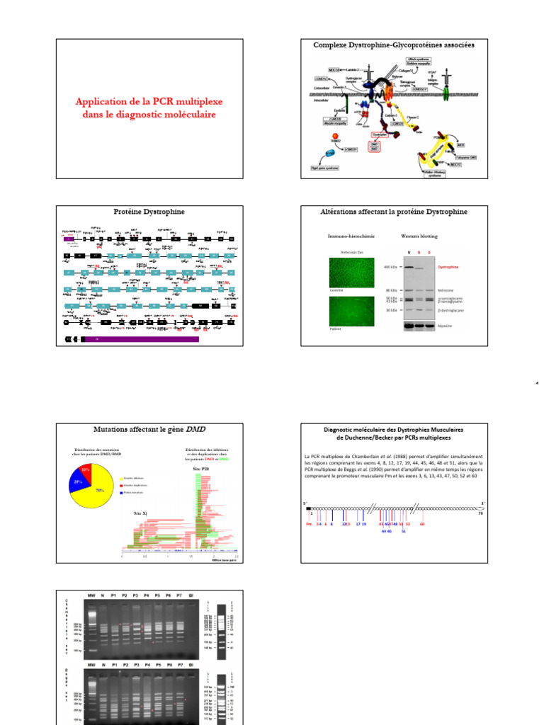 PCR multiplexe dans le diagnostic DMD/BMD | PDF