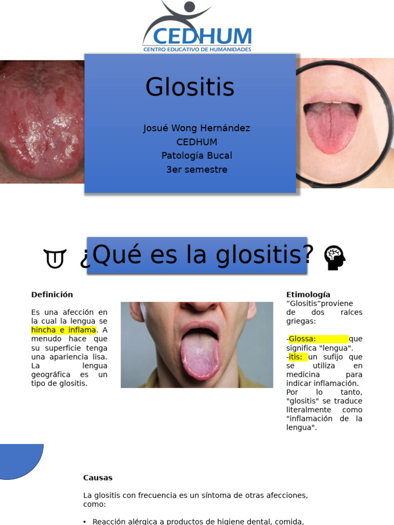 Glositis: Causas, Síntomas y Tratamiento | PDF | Odontología ...