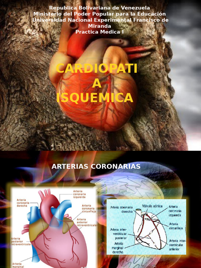 Cardiopatia Arreglada | PDF | Infarto de miocardio | Especialidades Medicas