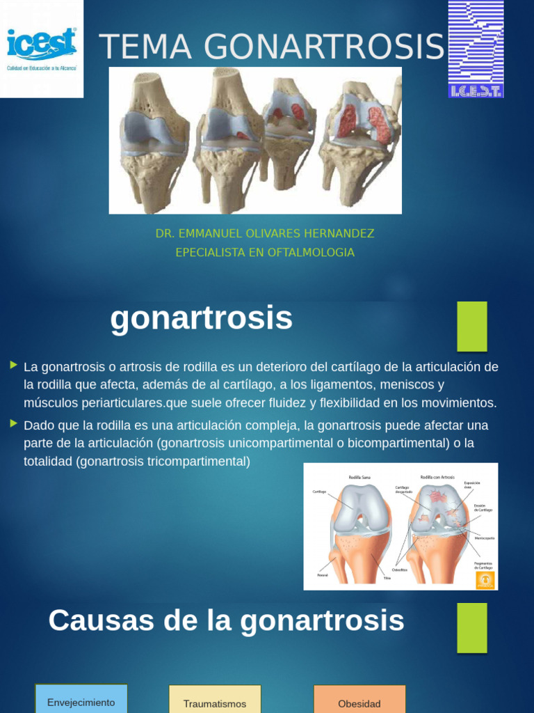 Gonartrosis: Causas, Síntomas y Tratamientos | PDF | Rodilla | Sistema ...