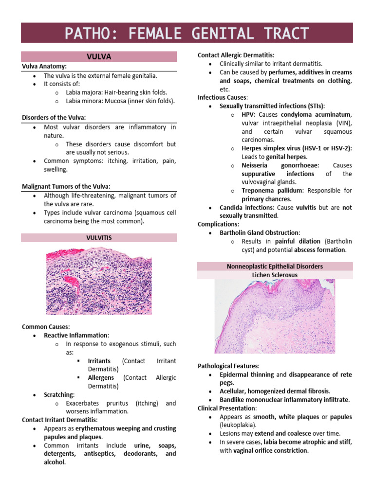 Female Genital Tract Pathology Overview | PDF | Carcinoma | Squamous ...