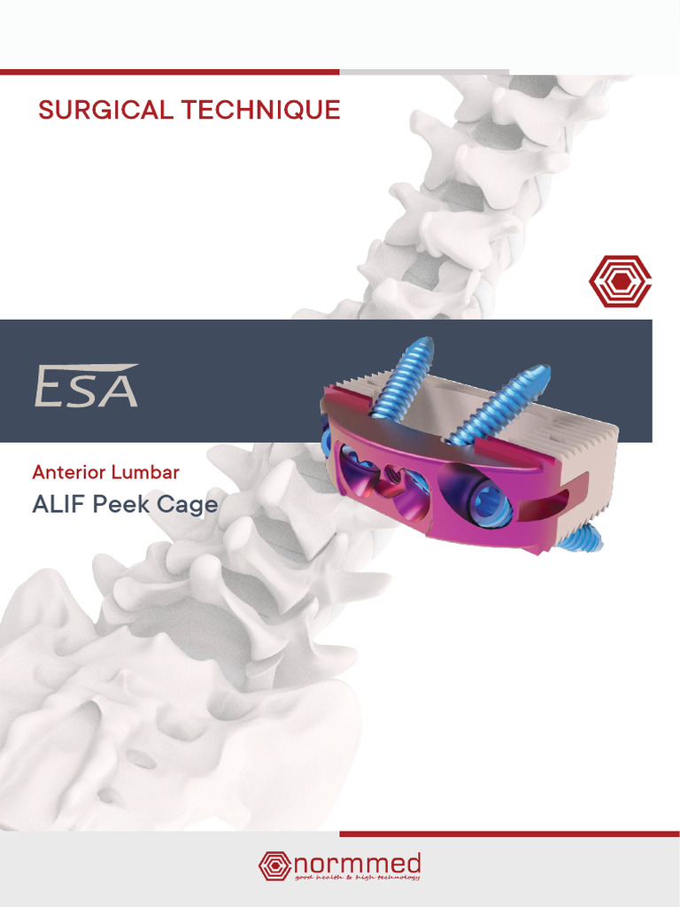 ALIF Surgical Technique with Peek Cage | PDF | Vertebra | Screw