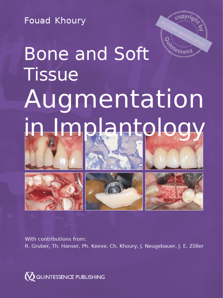 Leseprobe 14891 Khoury Bone and Soft Tissue | PDF | Dental Implant ...